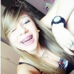 A loirinhÁ, de aparelho & olhos claros ♪ ! * 04i20 estraladooo . rs