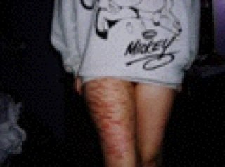 18 year old dancer suffering from self harm, eating disorders & depression 
CW: 116
GW: 100