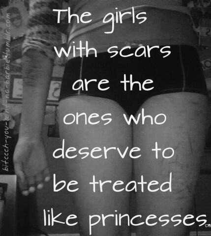 Every girl deserves Love, with Scars or without them.♥ Taylor, Cheyenne, and Elizabeth