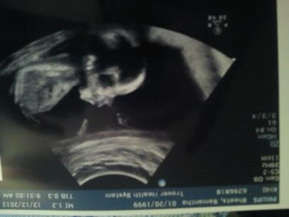 My baby..!!:)