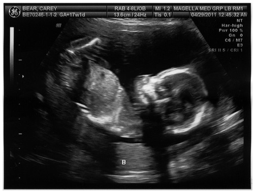 My mommy ia @TheTayJardine and my daddy is @jackbarakitty i cant wait to meet you all
