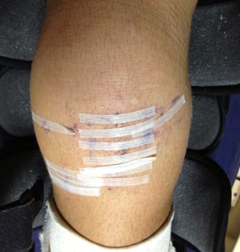 ACLFaith's profile picture. Never let anyone tell you you cant or wont, the only one who can control that is YOU! Beat the odds and prove them wrong! #aclfaith