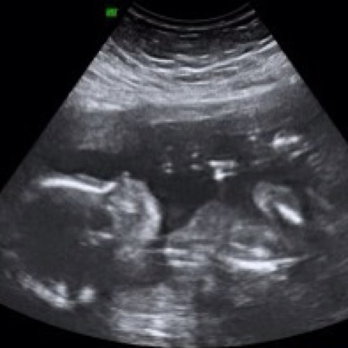 I am the unborn baby Girl of Kimberly. Waiting for my time to see the world. {RP|18+}