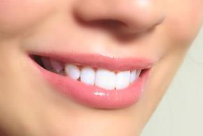 WhiterWhite offers you a safe, non peroxide teeth whitening system. The only products in the UK that do not damage teeth and guarantee great results 07969954570