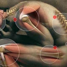 Todo sobre la fibromialgia y el ejercicio