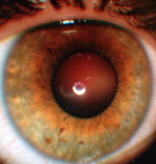 hi im James Maslow's right eye