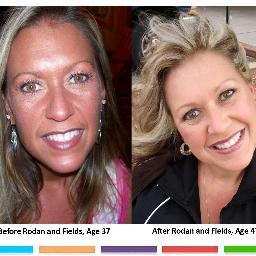 Looking for motivated individuals to help build my Rodan + Fields leadership team! Anyone want to earn 6 figures, retire in 2yrs? I'm having a blast! Join me!