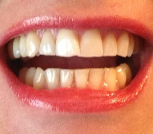 BeamingGnashers's profile picture. Your Gnashers Could Be Smashers!