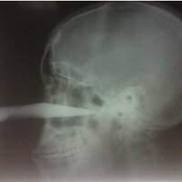 Tom (@thomaskilner) 's Twitter Profile