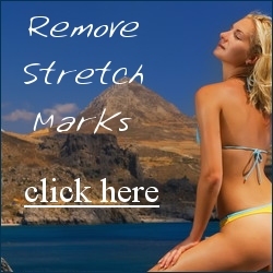 stretchmark123w's profile picture. Stretch Mark removal after Pregnancy. Get Natural Solution now at my Website.