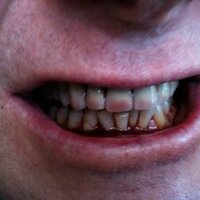 redteeth (@reillyterry) 's Twitter Profile