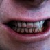 redteeth (@reillyterry) Twitter profile photo