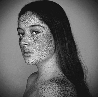 Freckle girl.
