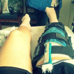 Acl45928670's profile picture. Been through both Acl reconstruction surgery's. Recovering from my second. Stay Positive.