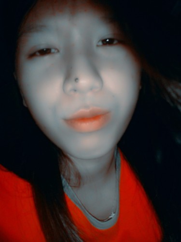 The wound heals, but the scar remains..