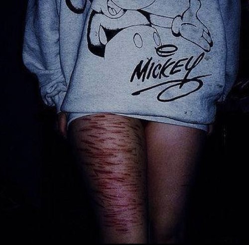 harm_selfharm's profile picture. 