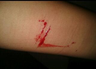 Self Harming for 2 years. I'm here to talk if you ever want to. ~may be triggering~