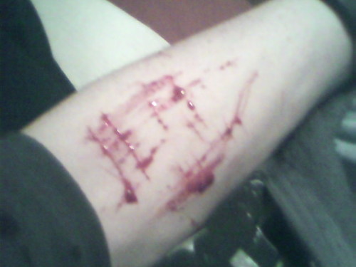 Just a normal 16/yr old self harmer going through bullying ect if yu want to know how im doing follow..