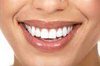 Safe non peroxide teeth whitening 30 mins