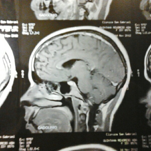 Adaquin's profile picture. me duele el oído