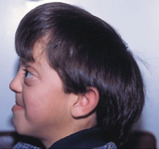 Estrogertido e um menino álegr e sinpatico