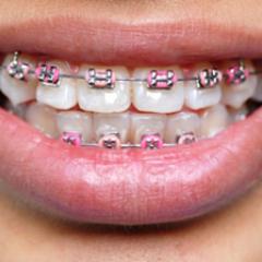 Braceface Problems! Follow us if you have/need/want braces! We follow back. Austin, Texas