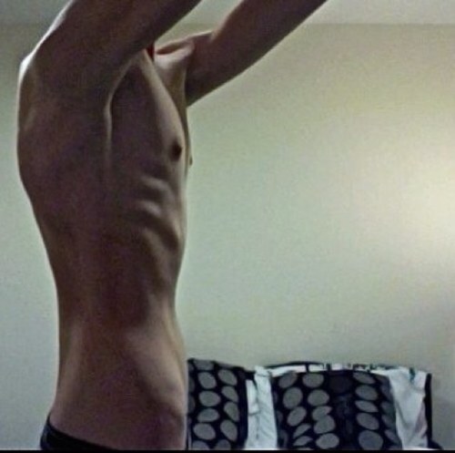 Anorexic | male | selfharm | 6'1 cw: 142