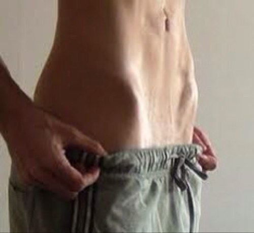 5'9 Cw:138.6 hw:143 lw:109 gw1:131 gw2:120 gw3:114 ugw:107 i am 15 and very muscular and athletic. i am relapsing (ana) and i want perfection.