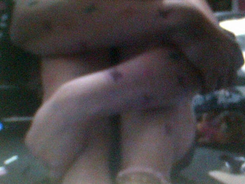 I'm 14, 98lbs , 45kg I have major depression, I self harm. I hate myself, bulimic, and suicidal
