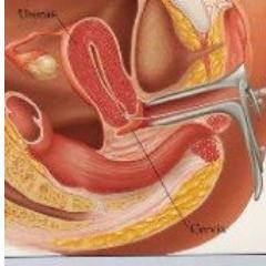 Iuisuccess88's profile picture. Tips, Guide and Resources for Iui Success