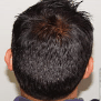 Finally—a natural approach to promote hair growth in men and women that works