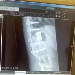 i luv laughing its answer 2everfin!trying 2spread awareness, my condition is rarer than1 in every milllion, please read my story!i want to try+ help,if i can?