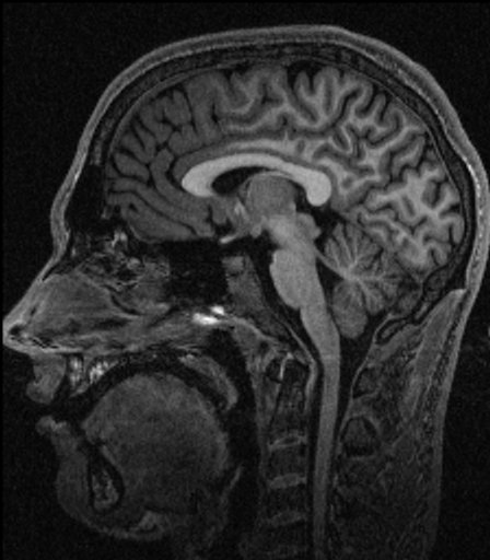 aayotee's profile picture. Professional pragmatist, CTO of @gsphantoms, MRI physicist, hardware hacker, science and technology enthusiast, sometimes makes music too.
