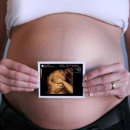 Our goal is to make your 3D 4D Ultrasound experience ONE NOT TO FORGET by offering the lowest prices and the best service in New York.