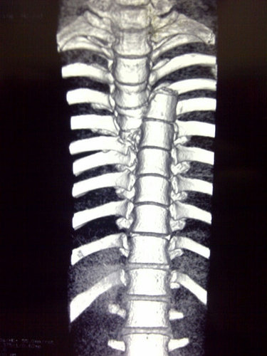 Orthopedic Spine Surgery Fellow
Tan Tock Seng Hospital, Singapore