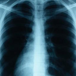 Respiratory Therapist
