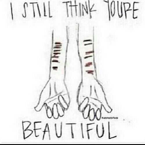 15 | Self Harmer | Depressed | Suicidal | Bi |Venting account | OM&M PTV SWS BMTH FIR and MCR saved me from the hell I call life. Days Clean: 0