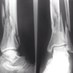 Orthopaedic Trauma (@ortho_trauma) Twitter profile photo
