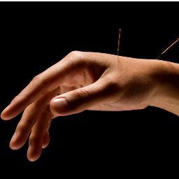 anna_AtSource's profile picture. Practising acupuncturist and member of BAcC, treating and promoting health and wellbeing in Gloucestershire.