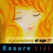 Essure sterilization is destroying women forcing them into hysterectomies at young ages. #Essure #EssureProblems https://t.co/OYobkjNQkD