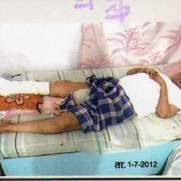 i m confied on bed 8 year.100% bodyparralysed.ineed help atyour handmy broter RAVI JAIN exp. app 15-20 lacks on meRAVI JAIN a/c no.32886510878 sbi bank bhilwara