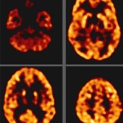 Official Twitter feed for Yale University PET Imaging Research Center, advancing molecular imaging research leading to applications in education and healthcare.