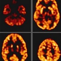 YalePETImagingCenter (@yalepet) 's Twitter Profile