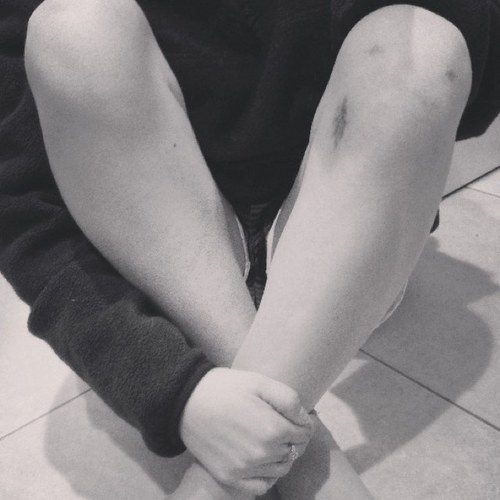 ACL_Fam's profile picture. You're not alone in this uphill battle. #ACLfam #soccer #StrikerLife