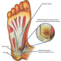 among the best foot doctors in Los Angeles. Look no further if you are in need of a Los Angeles podiatrist.