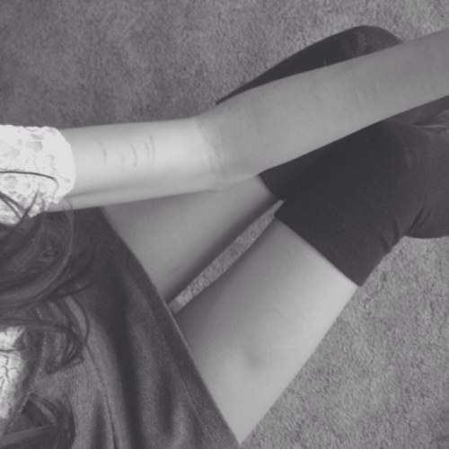 stitched up by flaws
