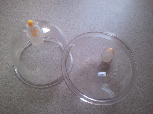 I'm a well experienced wet cupping therapist, I have 8 years experience. I'm based in Birmingham, UK,