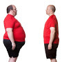 Harley Street Bariatrics, a weight loss clinic offering the latest surgical and non surgical treatments inc.: Gastric Band, Gastric Bypass and Spatz 3 balloon.