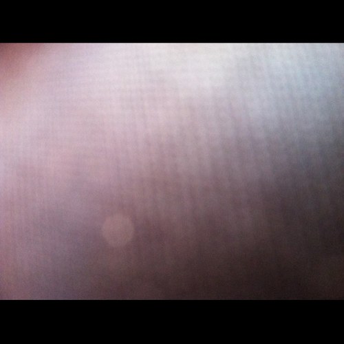 FriendsofKeith1's profile picture. We are a group of doctors, and other professionals from around the US and Canada fighting for Keith who lost his career due to CELIAC