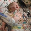 Help for Alexis (@22Q11Fundraiser) Twitter